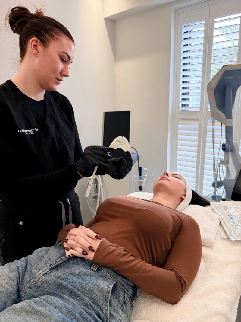 2025 11 20 Emsculpt 1