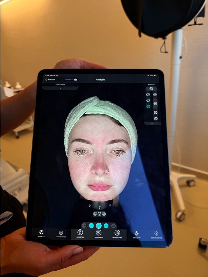 2026 07 27 Projuvenate Facial Scannin