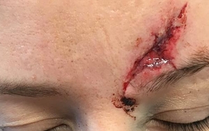 Do you know who hurt this woman in Heebie Jeebies?