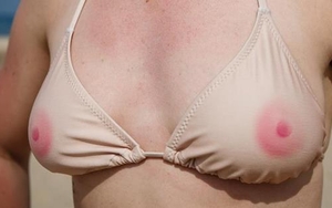 VOTE | Free The Nipple?